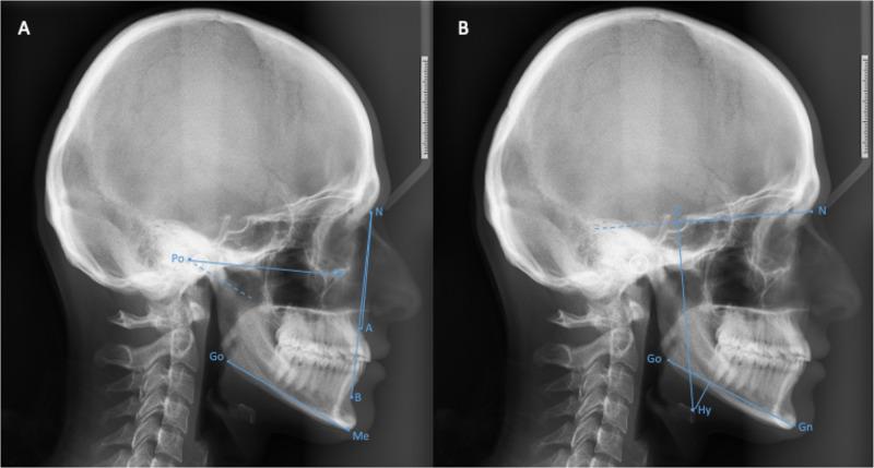 https://cdn.ncbi.nlm.nih.gov/pmc/blobs/6435/12065534/b0cb5182377e/NSS-17-801-g0002.jpg