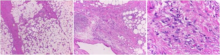https://cdn.ncbi.nlm.nih.gov/pmc/blobs/6436/7289738/6f6cd4b019c5/gr6.jpg