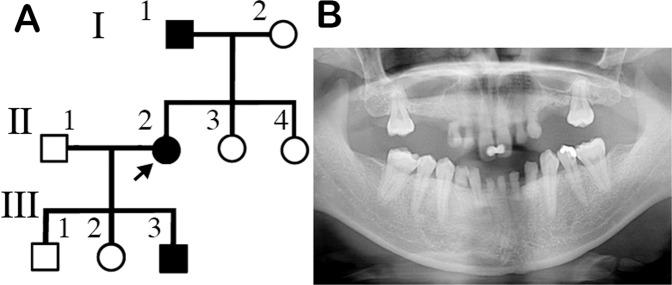 https://cdn.ncbi.nlm.nih.gov/pmc/blobs/6438/8292333/e0c48d62063c/41439_2021_162_Fig1_HTML.jpg