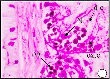 https://cdn.ncbi.nlm.nih.gov/pmc/blobs/643e/4397874/f583a4616b9b/40201_2015_171_Fig7_HTML.jpg