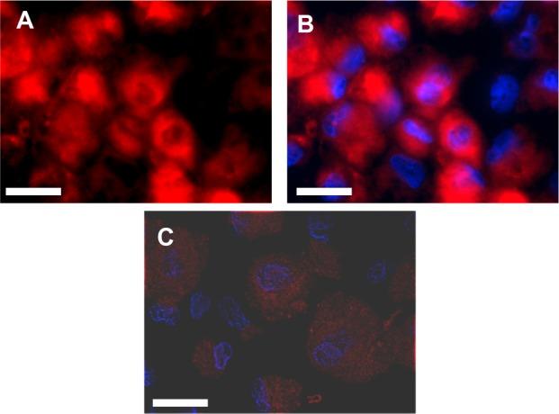 https://cdn.ncbi.nlm.nih.gov/pmc/blobs/6444/3986292/2c6b59ebfb9f/ijn-9-1731Fig1.jpg