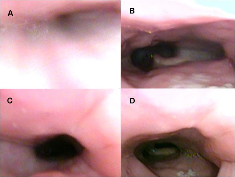 https://cdn.ncbi.nlm.nih.gov/pmc/blobs/6451/8627897/1fd37b4f35d8/NSS-13-2087-g0004.jpg