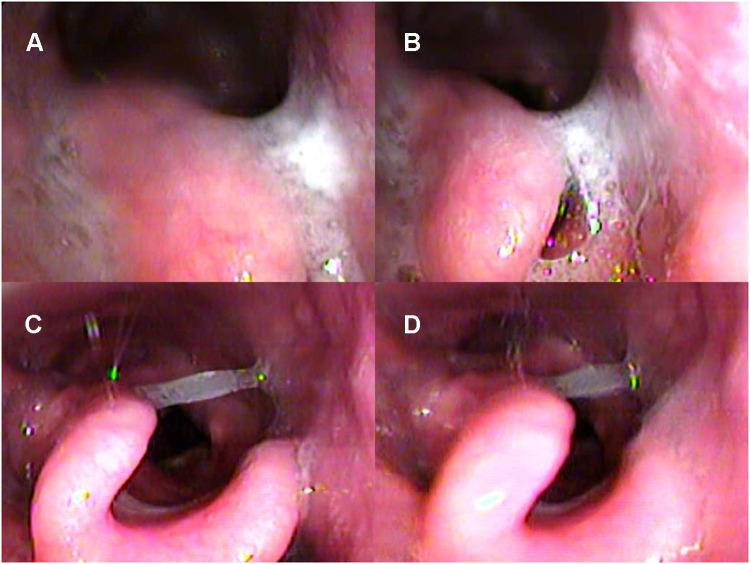https://cdn.ncbi.nlm.nih.gov/pmc/blobs/6451/8627897/ff3a5eb49bb6/NSS-13-2087-g0010.jpg