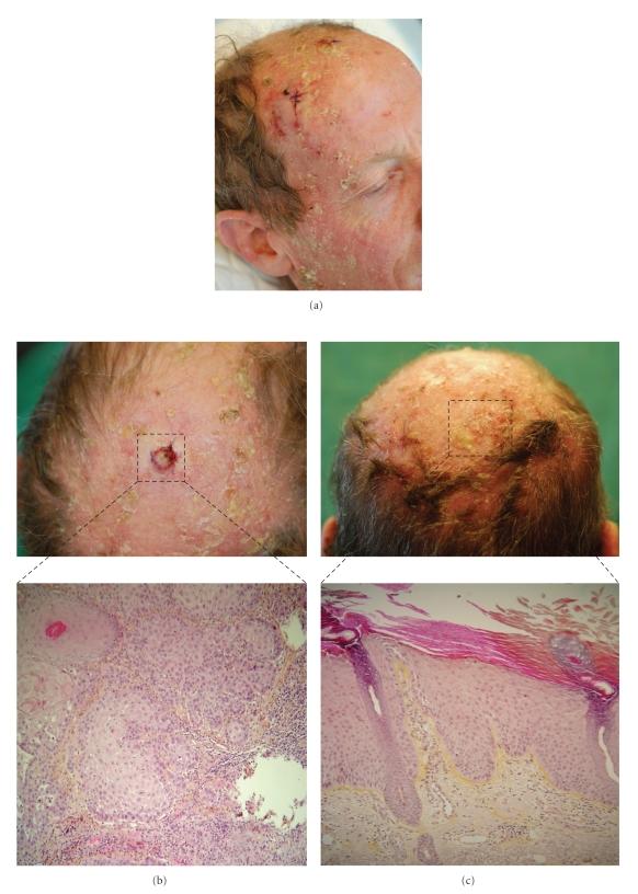 https://cdn.ncbi.nlm.nih.gov/pmc/blobs/6454/3014742/2436e768c78e/CRIM2010-351084.001.jpg