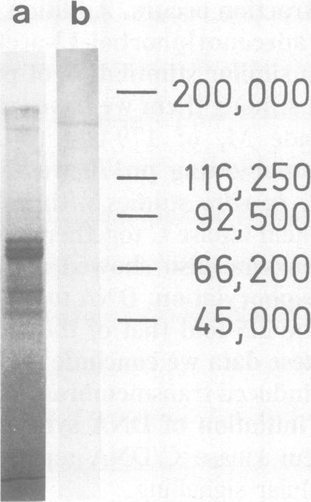 https://cdn.ncbi.nlm.nih.gov/pmc/blobs/6455/553872/323fd8e2b470/emboj00253-0070-c.jpg