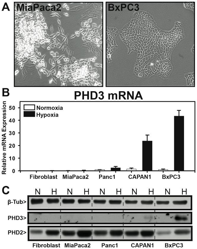 https://cdn.ncbi.nlm.nih.gov/pmc/blobs/645a/3867438/74fe293b4e02/pone.0083021.g004.jpg