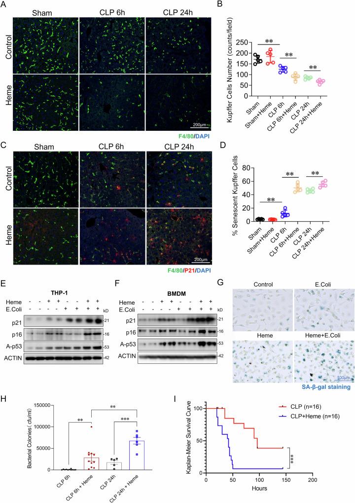 https://cdn.ncbi.nlm.nih.gov/pmc/blobs/645b/11993645/17f3ddbd2522/41419_2025_7637_Fig2_HTML.jpg
