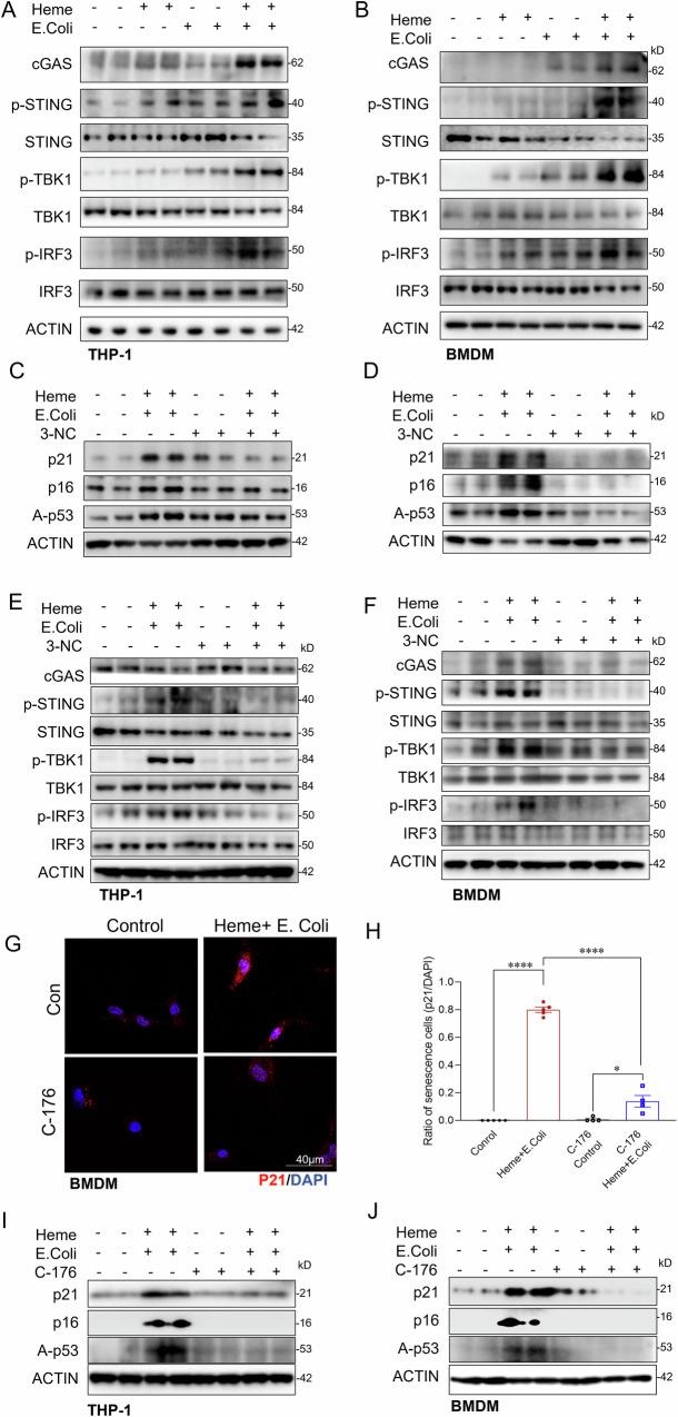 https://cdn.ncbi.nlm.nih.gov/pmc/blobs/645b/11993645/aea1fc44bd3c/41419_2025_7637_Fig7_HTML.jpg