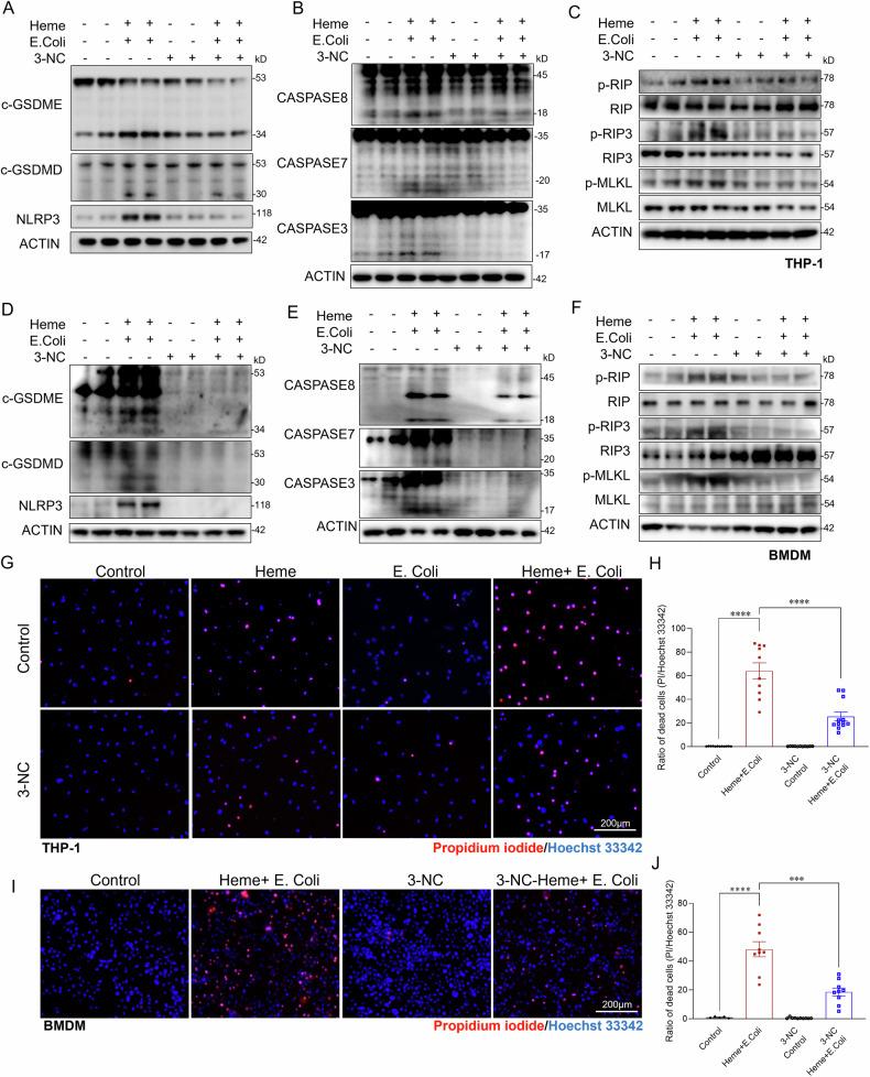 https://cdn.ncbi.nlm.nih.gov/pmc/blobs/645b/11993645/ba6bcab08fad/41419_2025_7637_Fig6_HTML.jpg