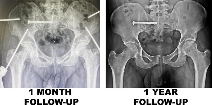 https://cdn.ncbi.nlm.nih.gov/pmc/blobs/645f/9945763/d8955ab8e3fc/gr3.jpg