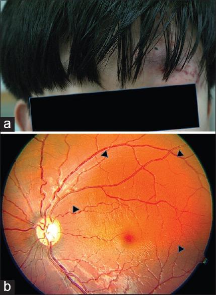 https://cdn.ncbi.nlm.nih.gov/pmc/blobs/6467/4550998/a4bd0acae888/IJO-63-554-g001.jpg