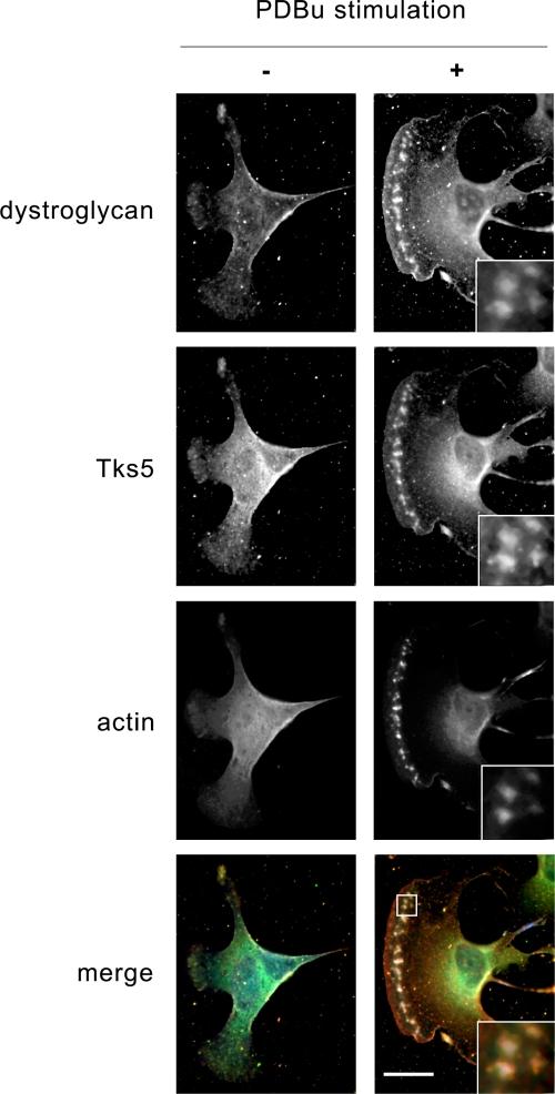 https://cdn.ncbi.nlm.nih.gov/pmc/blobs/6468/2572840/fdfe175b58b1/pone.0003638.g004.jpg