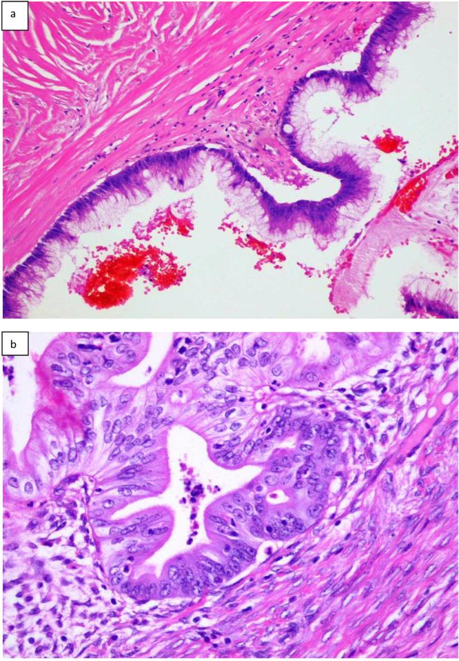 https://cdn.ncbi.nlm.nih.gov/pmc/blobs/6469/12138789/26bfefddb0f3/pore-31-1612066-g001.jpg