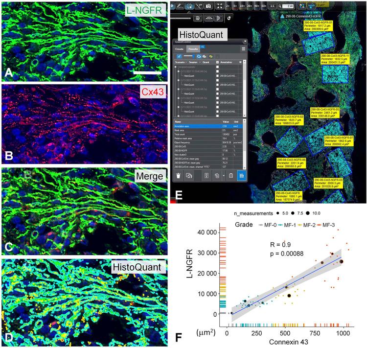 https://cdn.ncbi.nlm.nih.gov/pmc/blobs/646c/8958997/a686cdb91240/pore-28-1610217-g006.jpg