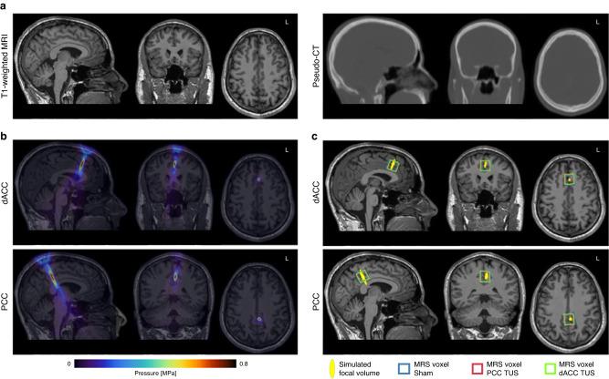 https://cdn.ncbi.nlm.nih.gov/pmc/blobs/646d/10474159/2f06b38981dd/41467_2023_40998_Fig3_HTML.jpg