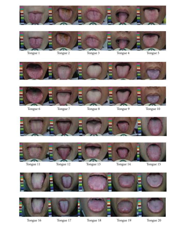 https://cdn.ncbi.nlm.nih.gov/pmc/blobs/646e/3424603/48779df9c004/ECAM2012-505063.004.jpg