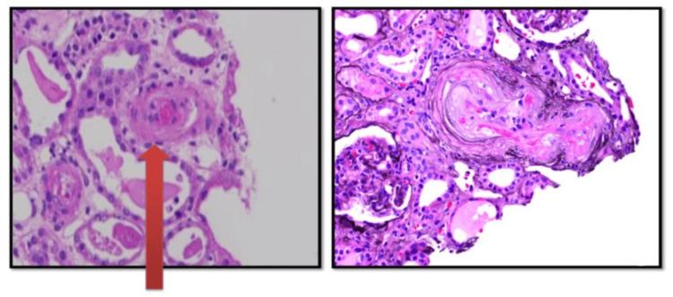 https://cdn.ncbi.nlm.nih.gov/pmc/blobs/6478/11646172/8b1e8c870faa/cureus-0016-00000073632-i04.jpg