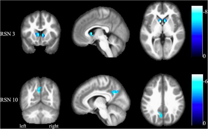 https://cdn.ncbi.nlm.nih.gov/pmc/blobs/647c/9354924/68ecd02e4789/fnins-16-957620-g002.jpg