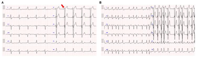 https://cdn.ncbi.nlm.nih.gov/pmc/blobs/647e/11576055/37f5ec34b7d7/cureus-0016-00000071949-i01.jpg