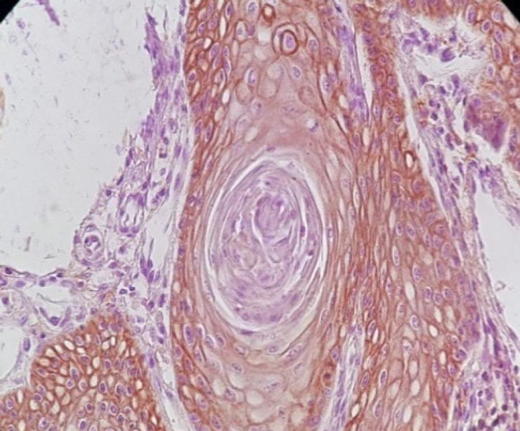 https://cdn.ncbi.nlm.nih.gov/pmc/blobs/6482/9924319/39da31b67172/APJCP-23-3571-g003.jpg