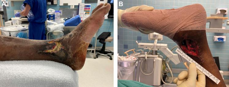 https://cdn.ncbi.nlm.nih.gov/pmc/blobs/6484/10337849/c8e7c20b4dc5/oi9-6-e235-g001.jpg
