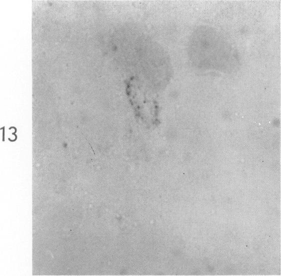 https://cdn.ncbi.nlm.nih.gov/pmc/blobs/6489/1949798/1bf2268e95ec/amjpathol00310-0023-a.jpg