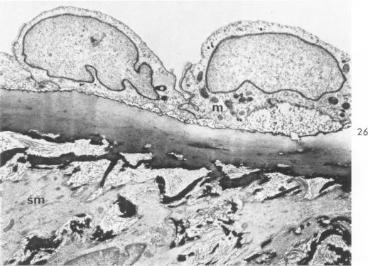 https://cdn.ncbi.nlm.nih.gov/pmc/blobs/6489/1949798/21eb90d0cf72/amjpathol00310-0025-b.jpg