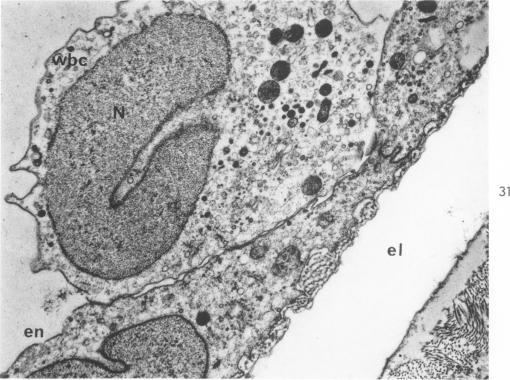 https://cdn.ncbi.nlm.nih.gov/pmc/blobs/6489/1949798/32b40e6c05ce/amjpathol00310-0031-a.jpg