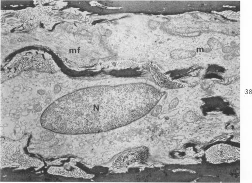 https://cdn.ncbi.nlm.nih.gov/pmc/blobs/6489/1949798/38849a562885/amjpathol00310-0037-b.jpg