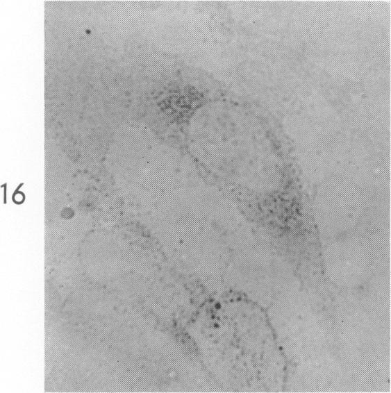 https://cdn.ncbi.nlm.nih.gov/pmc/blobs/6489/1949798/3f3d7eba58a5/amjpathol00310-0023-c.jpg