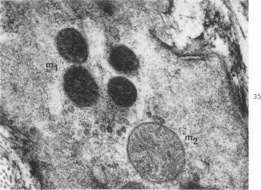 https://cdn.ncbi.nlm.nih.gov/pmc/blobs/6489/1949798/5fad2ae3225e/amjpathol00310-0035-a.jpg