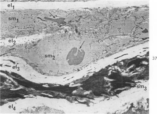 https://cdn.ncbi.nlm.nih.gov/pmc/blobs/6489/1949798/ba144a4d21cc/amjpathol00310-0037-a.jpg