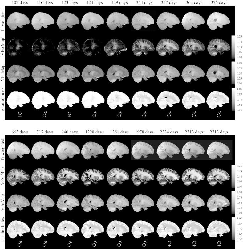 https://cdn.ncbi.nlm.nih.gov/pmc/blobs/648d/4862964/e8c49e25e620/gr9.jpg