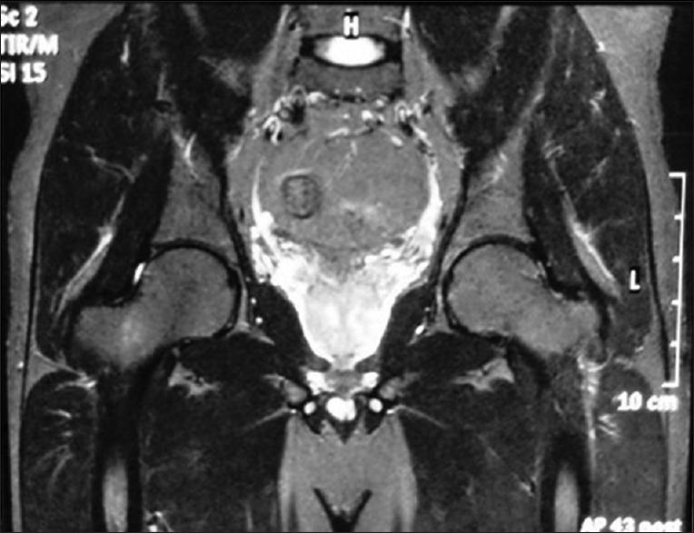 https://cdn.ncbi.nlm.nih.gov/pmc/blobs/6491/5525527/a5794b090a40/IJOrtho-51-455-g004.jpg
