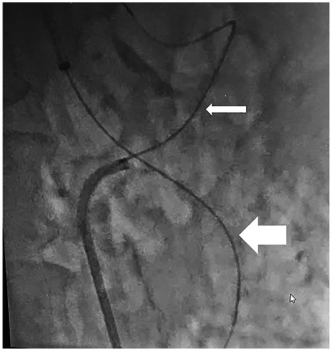 https://cdn.ncbi.nlm.nih.gov/pmc/blobs/6492/11420501/657231a931fc/gr3.jpg