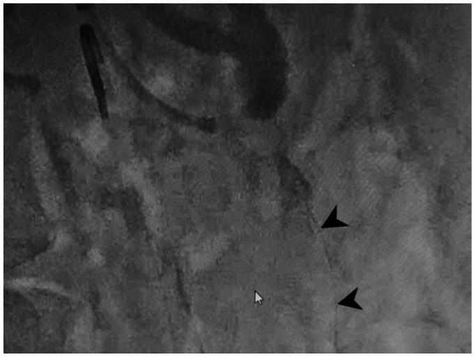 https://cdn.ncbi.nlm.nih.gov/pmc/blobs/6492/11420501/b7b2cb9cb026/gr2.jpg