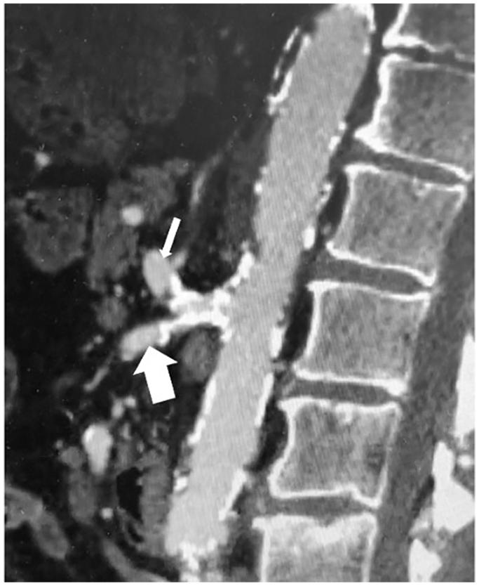 https://cdn.ncbi.nlm.nih.gov/pmc/blobs/6492/11420501/d1037397a76d/gr1.jpg