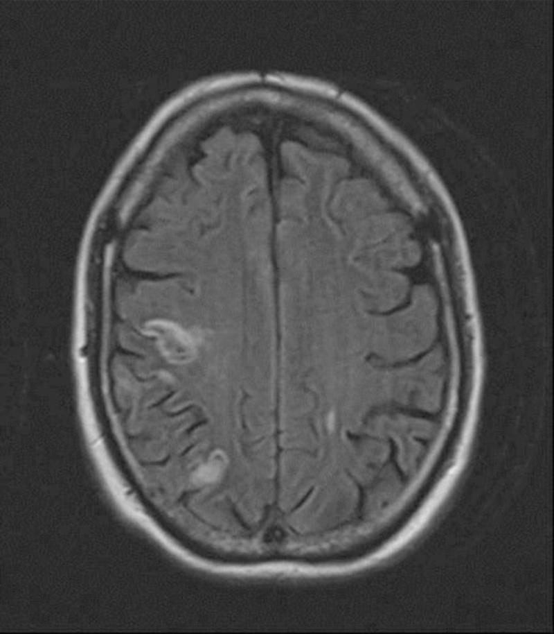 https://cdn.ncbi.nlm.nih.gov/pmc/blobs/6492/3545330/26dcd89dde81/SHORTS-12-01101.jpg