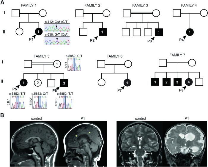 https://cdn.ncbi.nlm.nih.gov/pmc/blobs/6495/11140003/4576aa94ef89/41419_2024_6768_Fig1_HTML.jpg