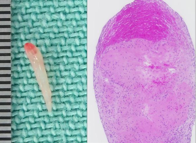 https://cdn.ncbi.nlm.nih.gov/pmc/blobs/649b/7418254/9672c93f9151/10.1177_2325967120942064-fig9.jpg
