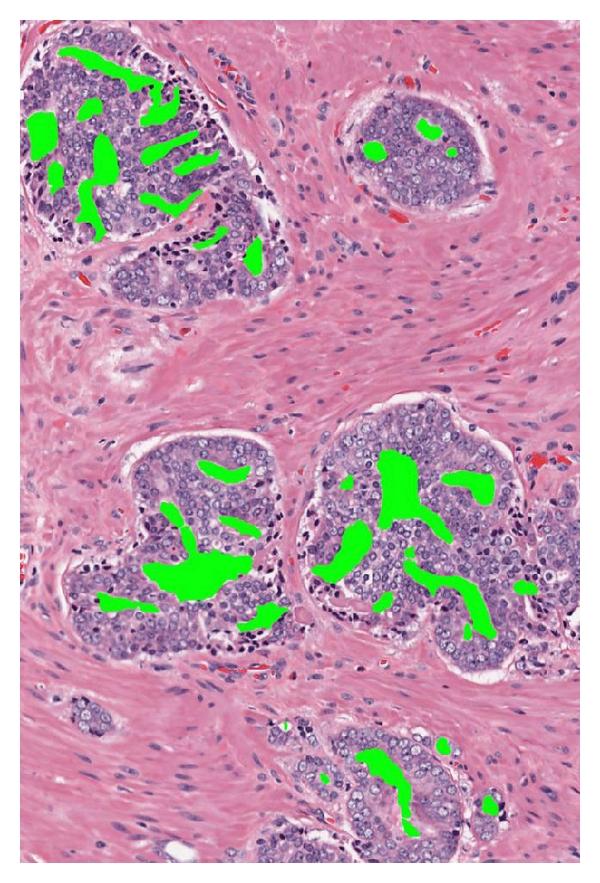 https://cdn.ncbi.nlm.nih.gov/pmc/blobs/649c/3200296/945e4f843425/PC2011-693853.002.jpg