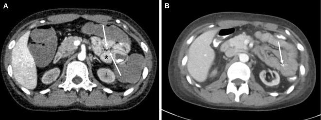 https://cdn.ncbi.nlm.nih.gov/pmc/blobs/649d/8502660/2ec125b3d3ce/1349-7235-60-2939-g004.jpg