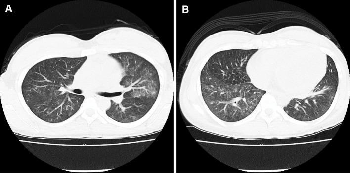https://cdn.ncbi.nlm.nih.gov/pmc/blobs/649d/8502660/de3b6bfa5a7e/1349-7235-60-2939-g001.jpg