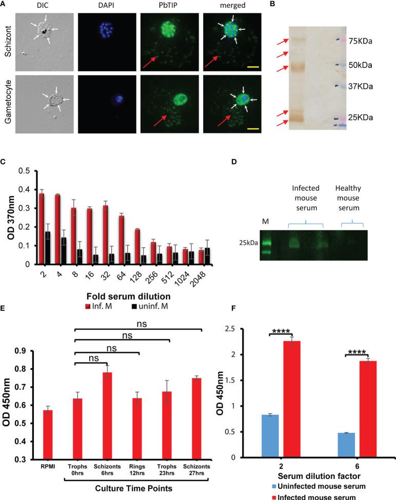 https://cdn.ncbi.nlm.nih.gov/pmc/blobs/64a2/8721568/a116c1ab0b6e/fimmu-12-699887-g004.jpg