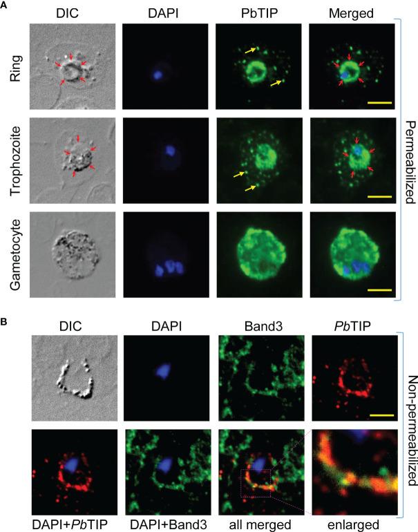 https://cdn.ncbi.nlm.nih.gov/pmc/blobs/64a2/8721568/a966c4c66777/fimmu-12-699887-g003.jpg