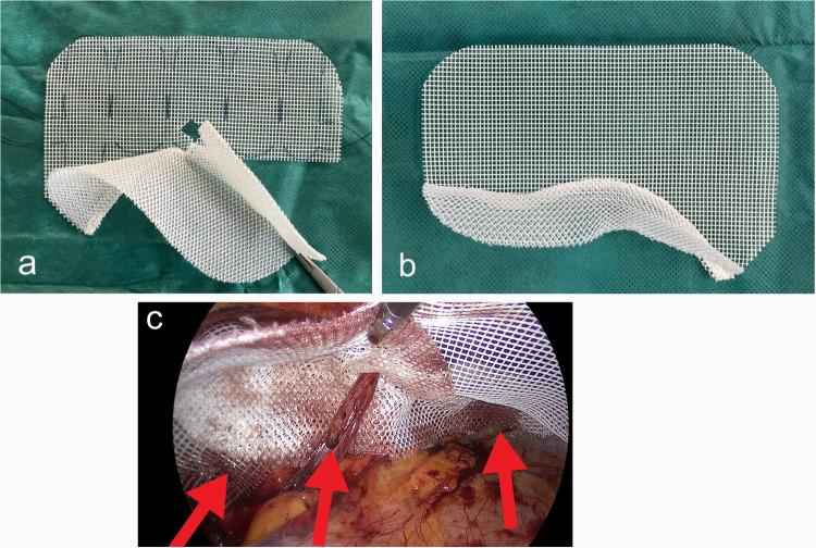 https://cdn.ncbi.nlm.nih.gov/pmc/blobs/64ae/12204938/525e4188e4dd/10029_2025_3394_Fig1_HTML.jpg