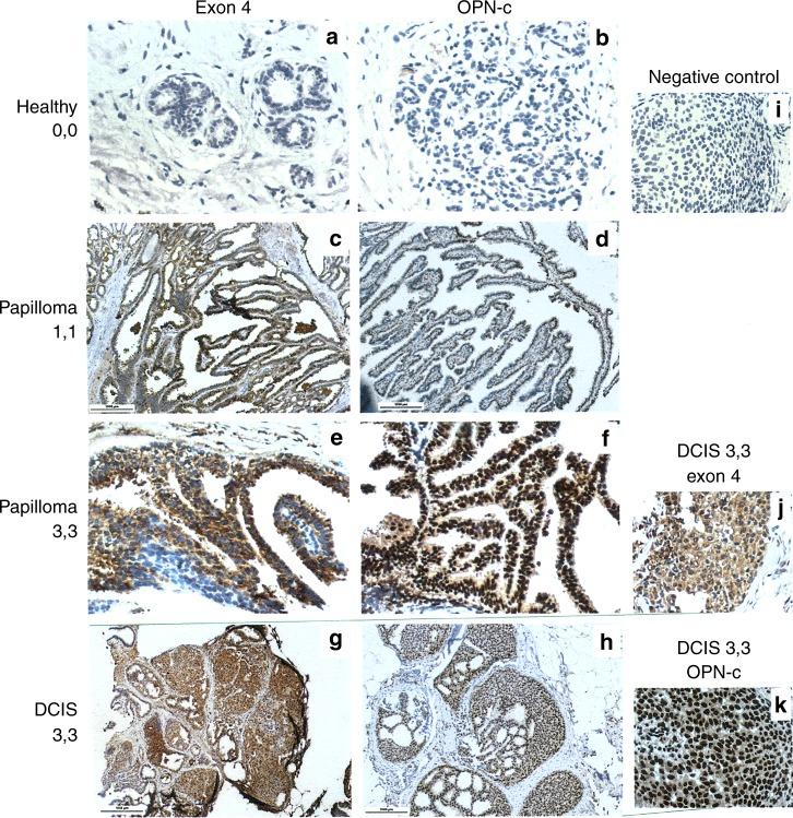 https://cdn.ncbi.nlm.nih.gov/pmc/blobs/64b5/6251032/a59a861c2a91/41416_2018_228_Fig1_HTML.jpg