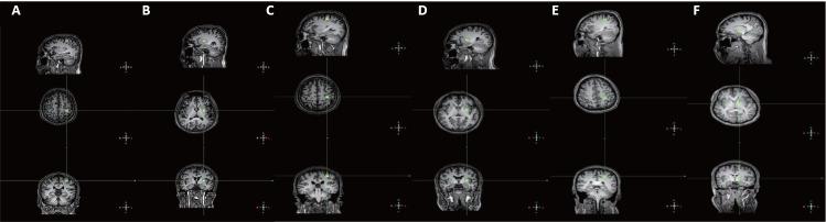 https://cdn.ncbi.nlm.nih.gov/pmc/blobs/64b5/9727442/a203fb8c571c/NRR-18-582-g003.jpg