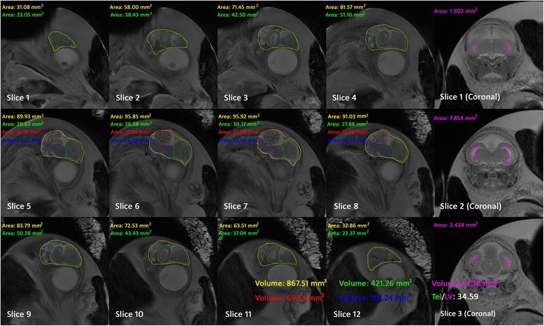 https://cdn.ncbi.nlm.nih.gov/pmc/blobs/64b6/4513430/b41c661f136e/12861_2015_77_Fig4_HTML.jpg