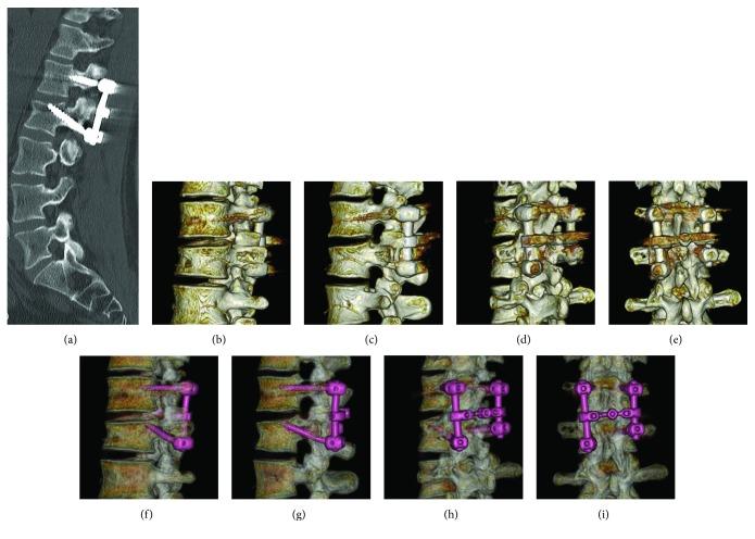 https://cdn.ncbi.nlm.nih.gov/pmc/blobs/64b6/6015715/74103de6dc27/CRIOR2018-8185051.004.jpg